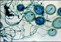 Endomycorrhiza